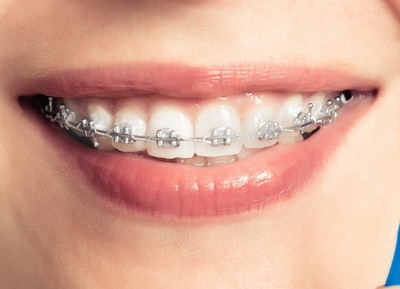 活动义齿和固定义齿哪种好_大连种植全口固定义齿