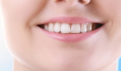 牙套的作用及危害(为什么需要牙套？)
