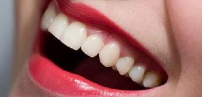 40岁矫正牙齿有哪些危害(40岁矫正牙齿有哪些危害)