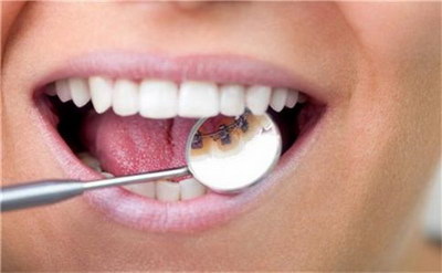 电动牙刷对牙齿的伤害_电动牙刷对牙齿的影响