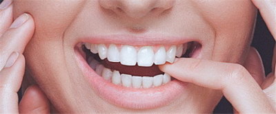 冷光美白牙有什么适应症的呢？