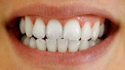 种植牙根能用多久(种植牙根要多久)