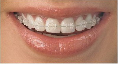 牙齿洗牙会伤牙釉质吗「洗牙抛光会不会伤害牙齿的牙釉质」
