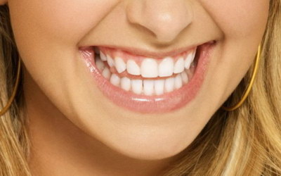 牙龈出现黑线怎么治疗