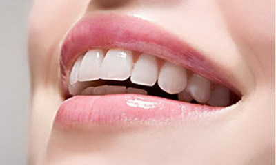 牙齿美白可以做什么手术