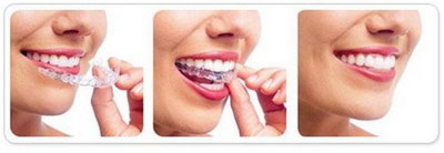 牙斑显示剂的用途