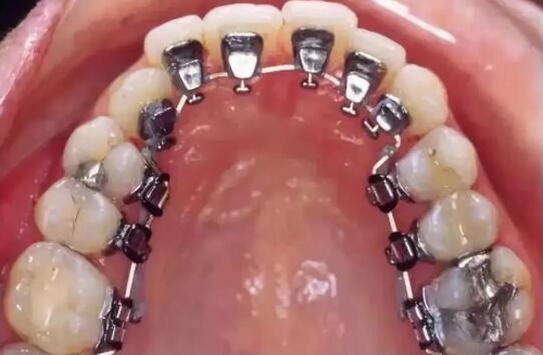 牙齿是什么科室(牙齿断了挂什么科室)
