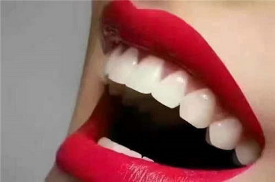 牙齿面黄色牙菌斑照片(为什么牙齿会变黄？)