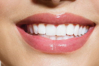牙性偏颌怎么矫正(偏颌怎么看是骨性还是牙性)