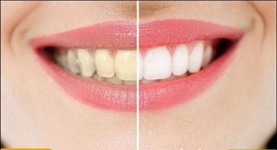 补牙时的液体是什么?