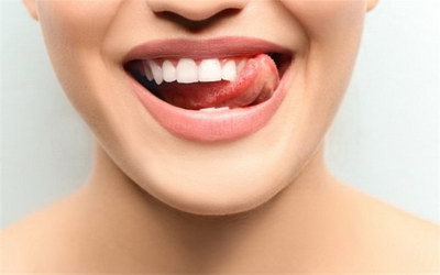 怎么清洁牙齿牙垢(牙齿和牙齿之间怎么清洁)