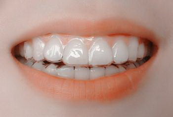 修复牙齿手术安不安全？