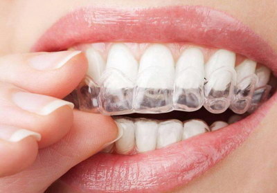牙齿矫正中途放弃的危害「牙齿矫正中途怀孕有影响吗」