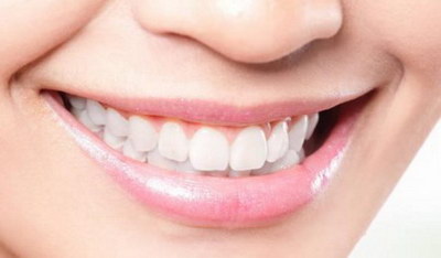 牙齿隐形矫正需要磨牙吗