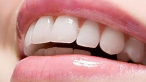 牙周炎牙齿脱落适合种植牙吗