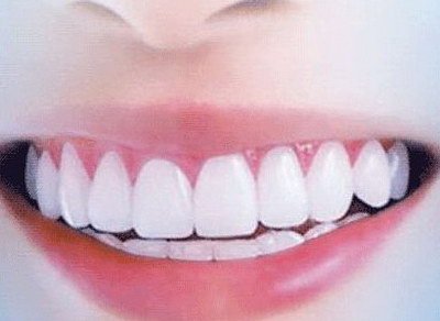 牙齿整形适合的漱口水_骨性牙齿整形有效果吗
