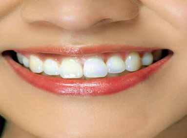 牙齿桥体组织设计类型