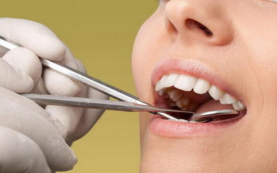 根管治疗后怎么做_根管治疗牙髓摘除