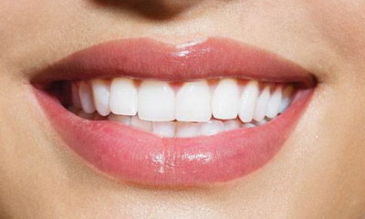 牙齿矫正哪种方式时间最短