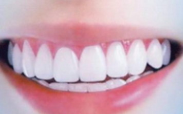 乳牙不整齐是什么原因_刚冒出来的乳牙不整齐