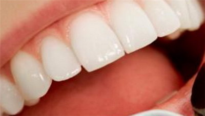 门牙缝树脂补牙能用多久