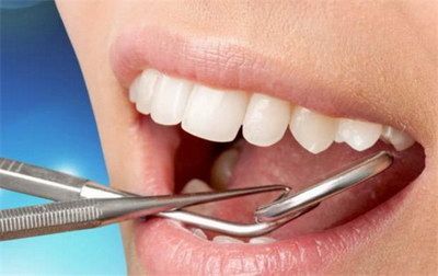 牙神经坏死治疗后又烂了：这是一个常见的问题_乳牙牙神经杀死对牙的危害