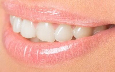 牙齿矫正哪种类型最容易矫正