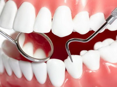 龅牙矫正方法有哪些_隐形龅牙矫正器