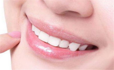 牙齿美白哪种方法伤害最小_牙齿美白哪种方法伤害小