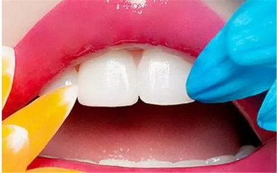 拔牙有什么危害出血了该做什么呢？