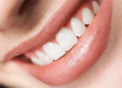 成人矫正牙齿能解决什么问题