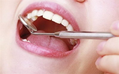 牙周治疗后牙龈疼_洗完牙以后牙龈出血怎么办