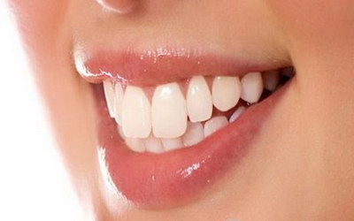 牙齿镶嵌体一般能保持多久