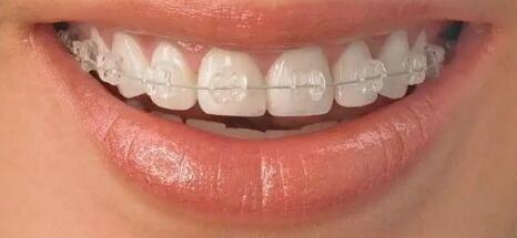 拔牙牙根留在里面有什么影响_最新矫正牙齿无需拔牙的方法