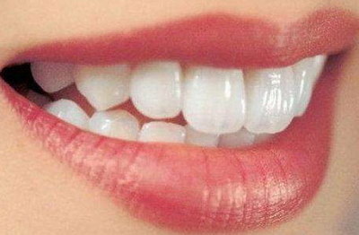 牙齿整形最佳年龄