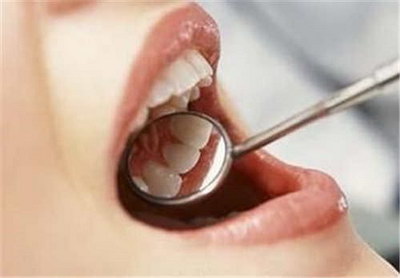 无锡牙齿根管治疗费用