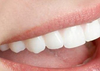 无锡戴牙套要多久_戴牙套中途可以做根管治疗吗