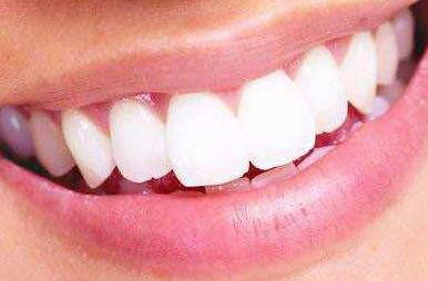牙齿上下牙错位咬合图_牙齿上下牙错位需要矫正吗