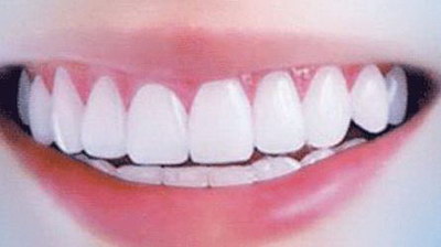 人体骨头牙齿(牙齿算不算人体骨头的一部分)