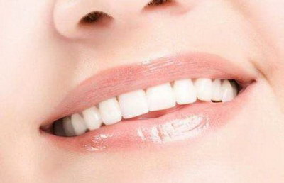 牙齿保持器保质期_牙齿是如何正畸的