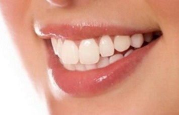 牙齿出现黑点【为什么牙齿上有黑点还出现洞】