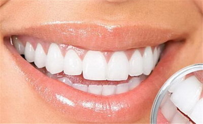 成年女性多少颗牙齿