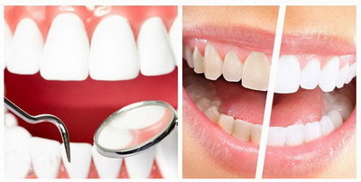 牙齿蛀斑怎么处理
