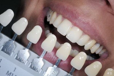 种牙时间多长(种牙需要多长时间？)