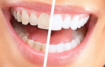 儿童有多少颗牙齿10~13岁(儿童牙齿一共有多少个)