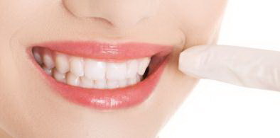以牙齿上打桩：一种新的现代方式_牙后缩上牙嘴翘牙齿整齐的重要性