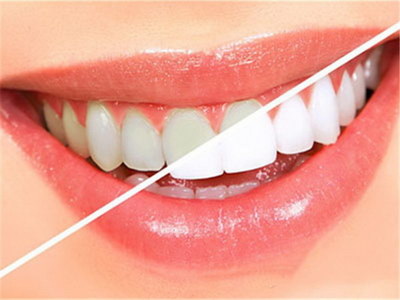 做完根管治疗后牙酸(牙齿根管治疗后牙酸)