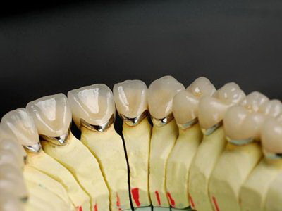 牙齿正畸导致下颌骨难受(牙齿正畸导致下颌骨紊乱)