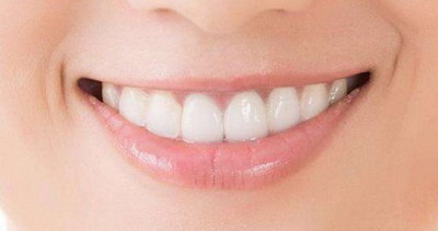牙齿缝隙发黑蛀牙_牙齿缝隙大戴牙套