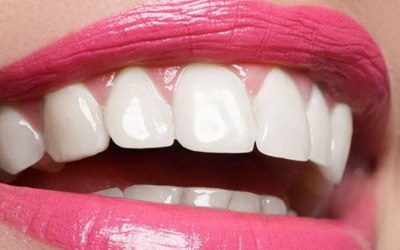 四种牙齿美白方法让你重回美丽